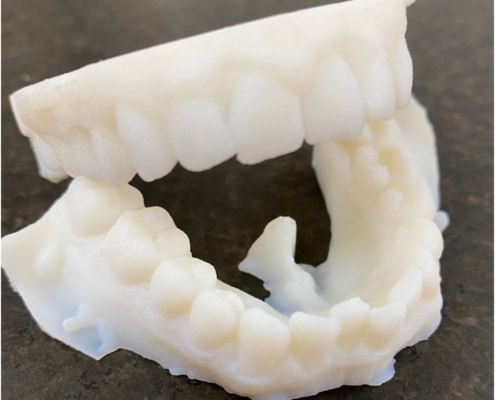 Impresión 3D - Modelo dental de resina líquida
