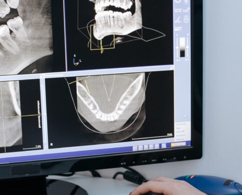 Imagenes escaneadas de dentadura