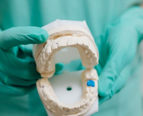 Impresión dental 3D